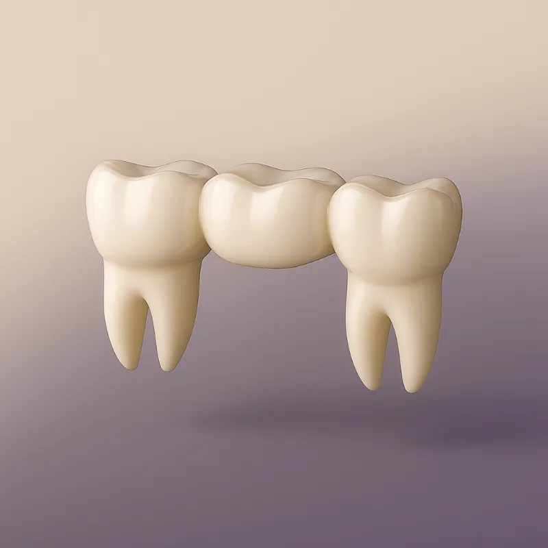 Fixed porcelain bridge replacing teeth